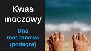 Kwas moczowy  dna moczanowa podagra [upl. by Lednyc]