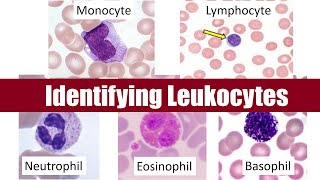 Identifying Leukocytes [upl. by Ibocaj]